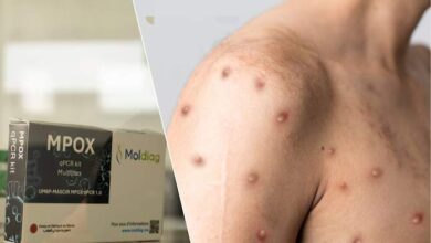 متغير Mpox في بلجيكا